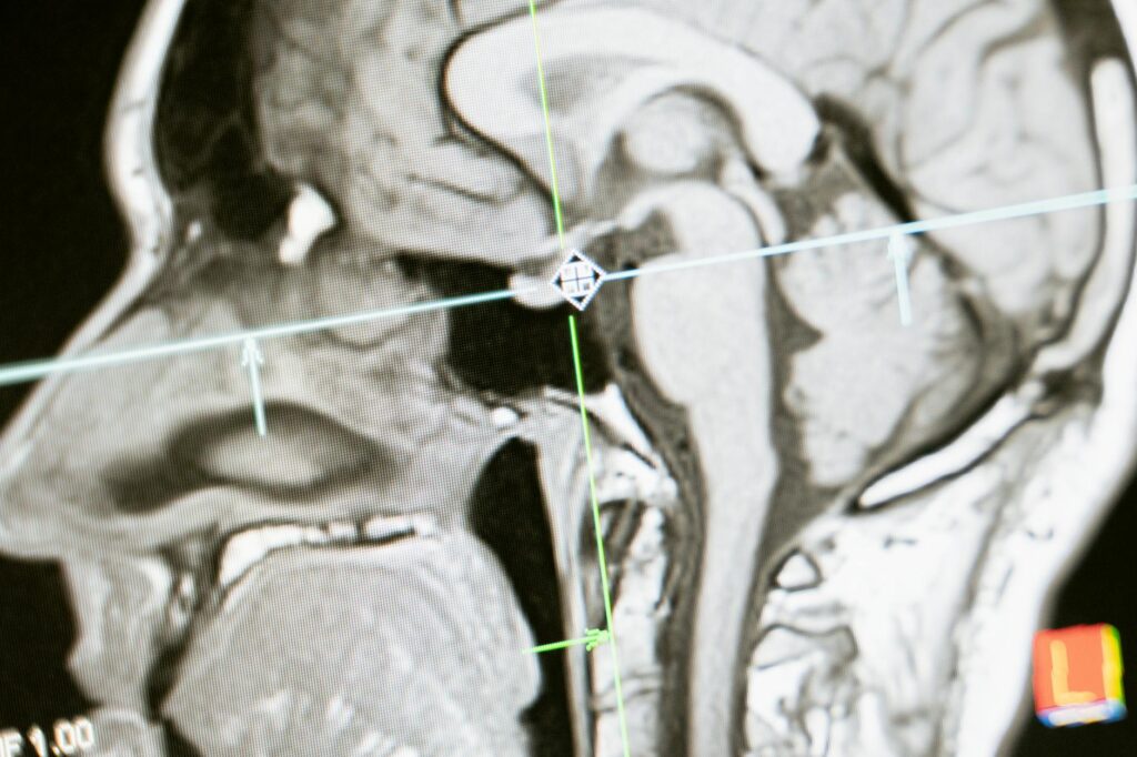 What is add diagnosis?