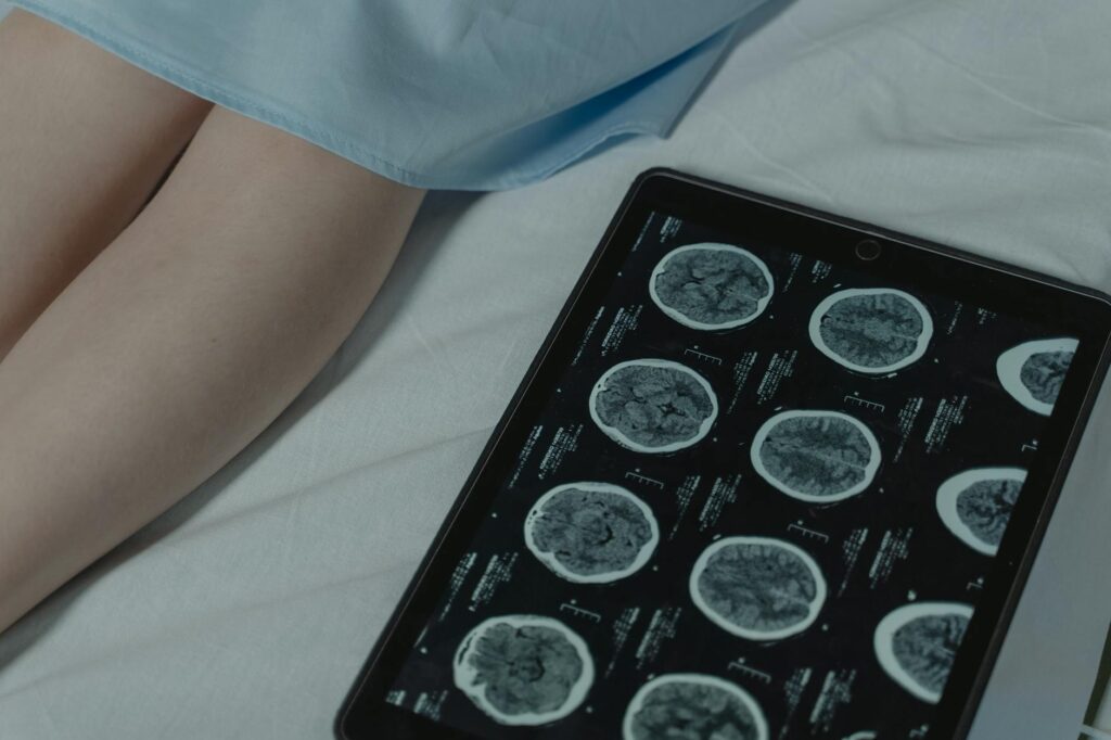 What is brain dump technique?
