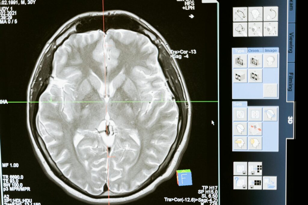 What is neurological assessment?